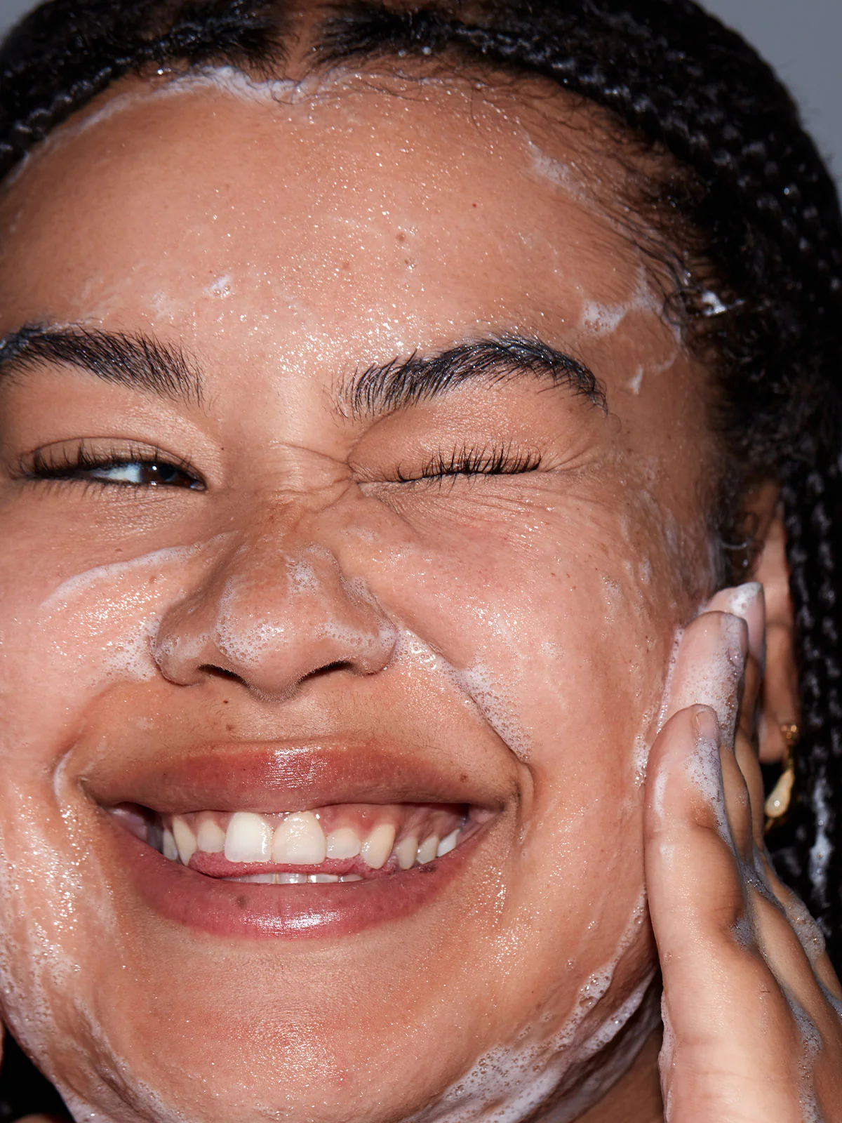 After Acne® - Image 3